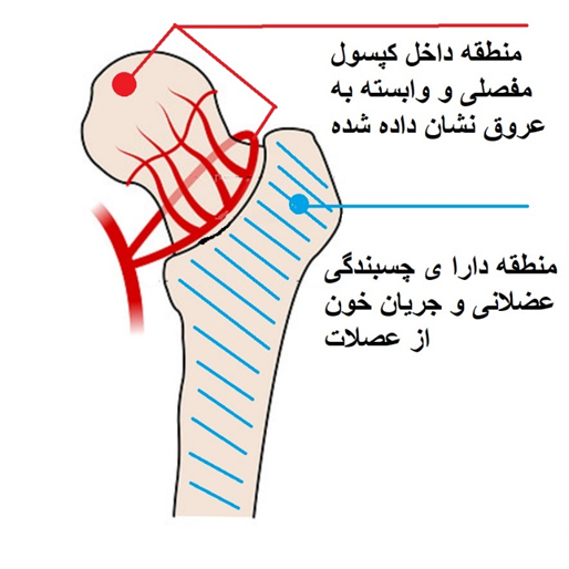 خونرسانی به سر و گردن استخوان ران