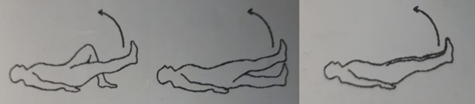 کشش همسترینگ