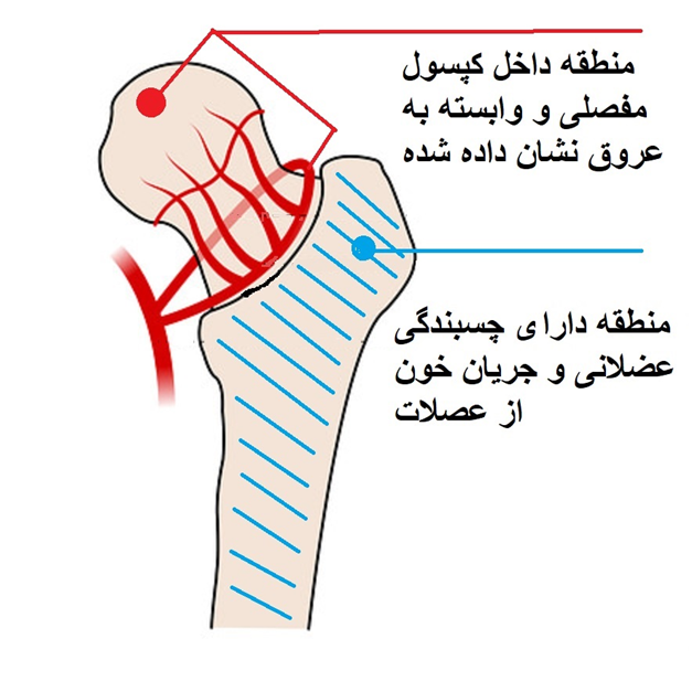 خونرسانی سر و گردن فمور