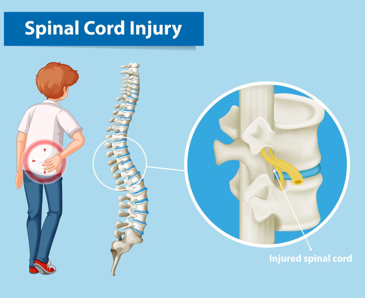 فیزیوتراپی و ضایعات نخاعی (Spinal Cord Injury) - قسمت اول