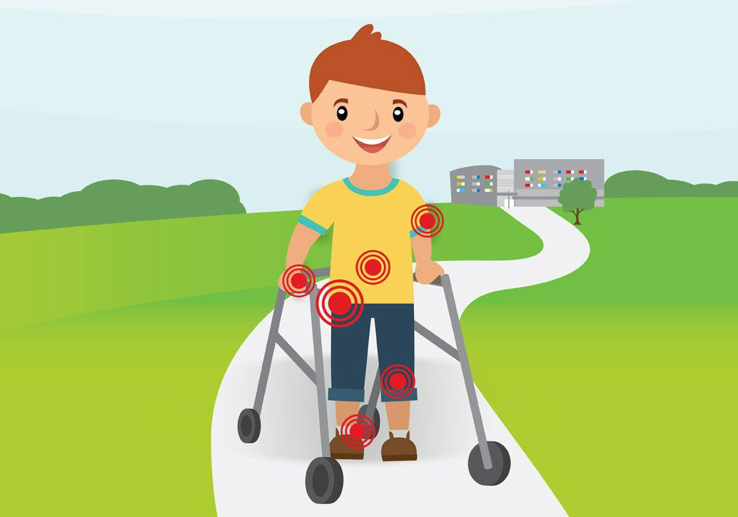 فیزیوتراپی و فلج مغزی (Cerebral palsy)