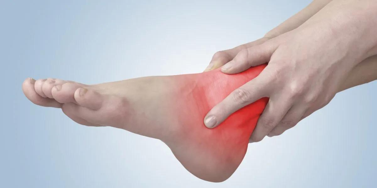 شناخت عارضه تاندونیت آشیل (Achilles Tendonitis) درمان و فیزیوتراپی آن